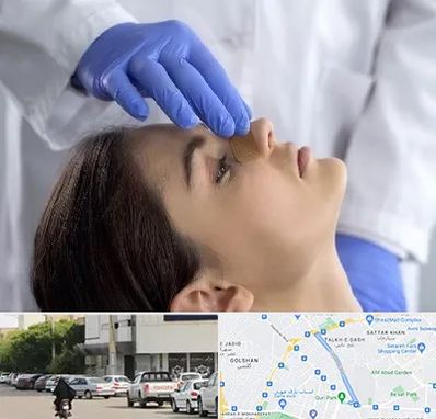 عمل بینی عروسکی در قدوسی شرقی شیراز