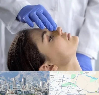 عمل بینی عروسکی در شمال شرق تهران