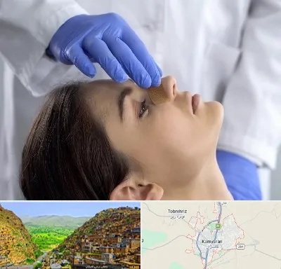 عمل بینی عروسکی در کامیاران