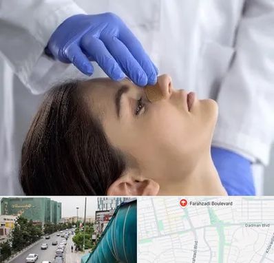 عمل بینی عروسکی در بلوار فرحزادی