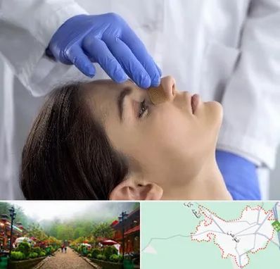 عمل بینی عروسکی در فومن