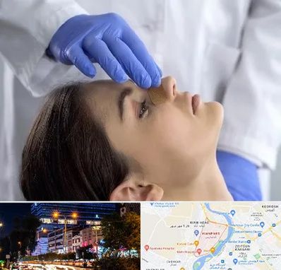 عمل بینی عروسکی در کیانپارس اهواز