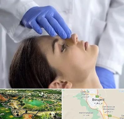 عمل بینی عروسکی در بروجرد