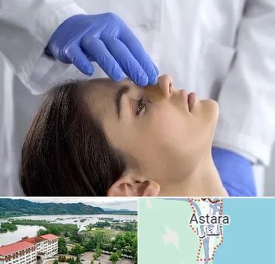 عمل بینی عروسکی در آستارا