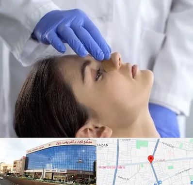 عمل بینی عروسکی در نصف راه تبریز