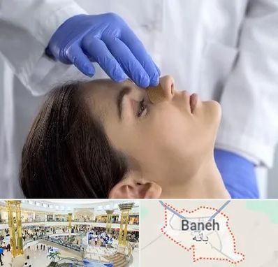 عمل بینی عروسکی در بانه