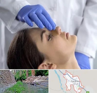 عمل بینی عروسکی در سراوان
