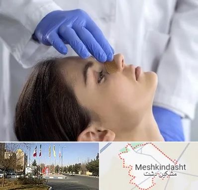 عمل بینی عروسکی در مشکین دشت