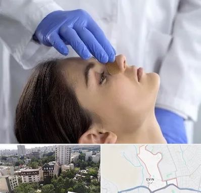 عمل بینی عروسکی در اوین