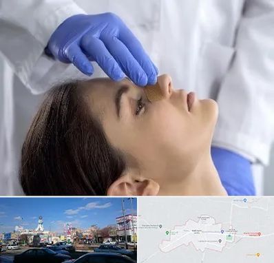 عمل بینی عروسکی در ماهدشت کرج