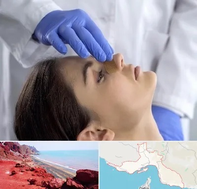 عمل بینی عروسکی در هرمزگان
