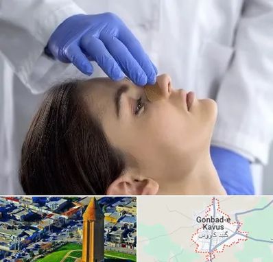عمل بینی عروسکی در گنبد کاووس
