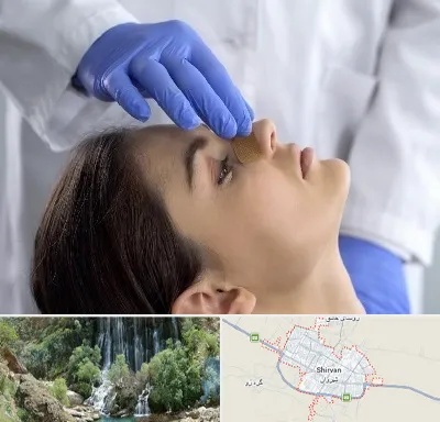 عمل بینی عروسکی در شیروان