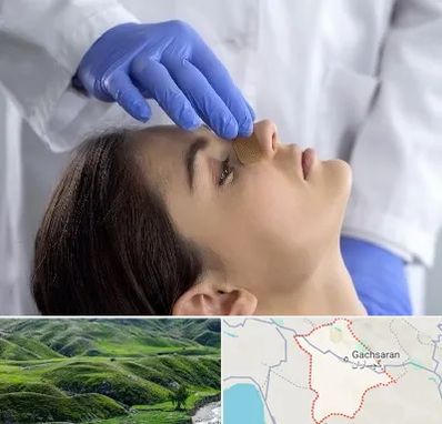 عمل بینی عروسکی در گچساران
