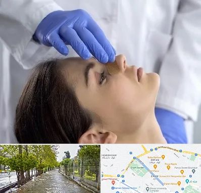 عمل بینی عروسکی در خیابان ارم شیراز