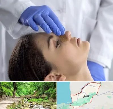عمل بینی عروسکی در گلستان