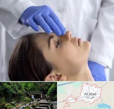 عمل بینی عروسکی در علی آباد کتول