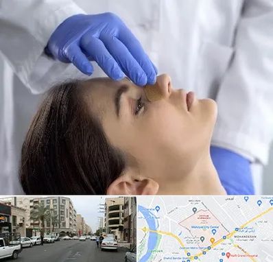 عمل بینی عروسکی در زیتون کارمندی اهواز