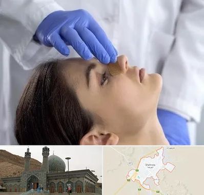 عمل بینی عروسکی در شهرضا