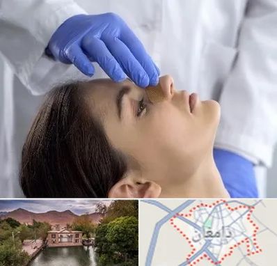 عمل بینی عروسکی در دامغان