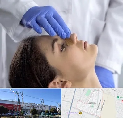 عمل بینی عروسکی در فاز دو اندیشه