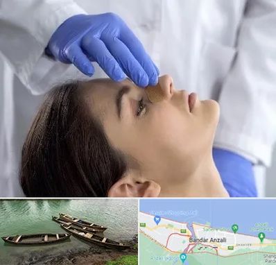 عمل بینی عروسکی در بندر انزلی