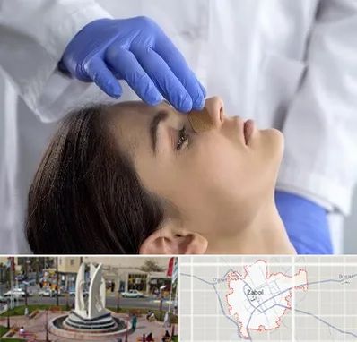 عمل بینی عروسکی در زابل