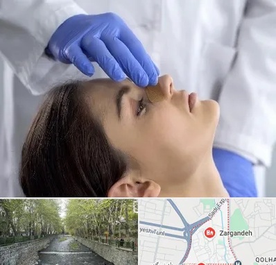 عمل بینی عروسکی در زرگنده