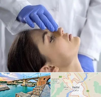 عمل بینی عروسکی در دزفول