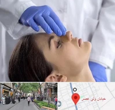 عمل بینی عروسکی در ولیعصر شهریار