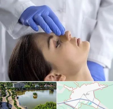 عمل بینی عروسکی در لنگرود