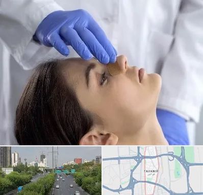 عمل بینی عروسکی در توانیر