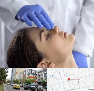 عمل بینی عروسکی در هفده شهریور تبریز