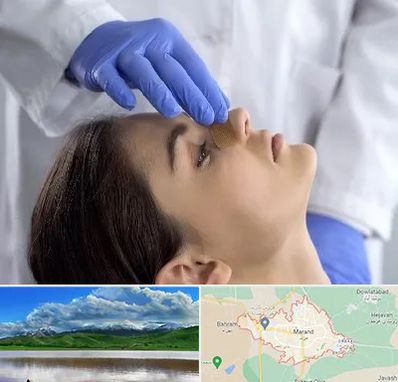 عمل بینی عروسکی در مرند