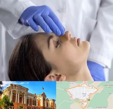 عمل بینی عروسکی در خوی