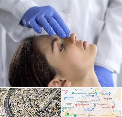 عمل بینی عروسکی در شهرک غرب مشهد