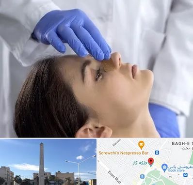 عمل بینی عروسکی در فلکه گاز شیراز