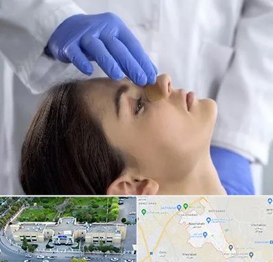 عمل بینی عروسکی در نسیم شهر