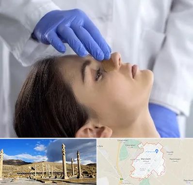 عمل بینی عروسکی در مرودشت