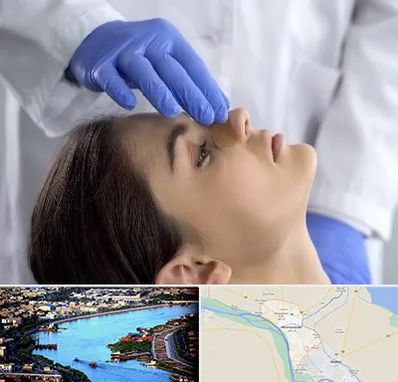 عمل بینی عروسکی در خرمشهر