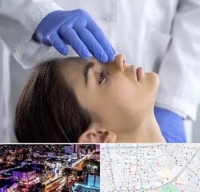 عمل بینی عروسکی در منظریه رشت