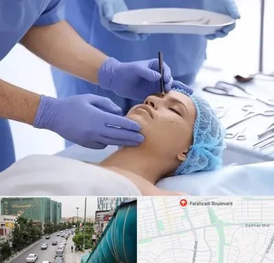 عمل بینی طبیعی در بلوار فرحزادی