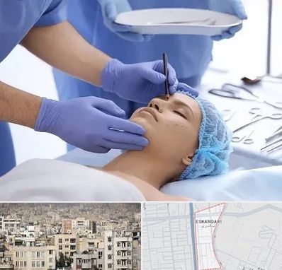 عمل بینی طبیعی در اسکندری