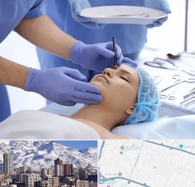 عمل بینی طبیعی در ازگل