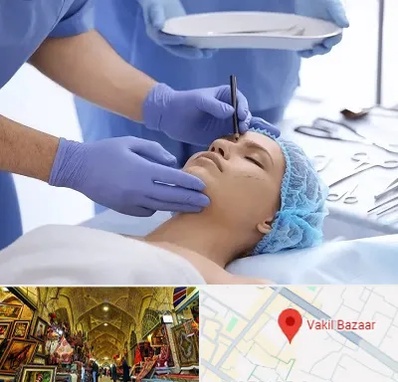 عمل بینی طبیعی در بازار وکیل شیراز