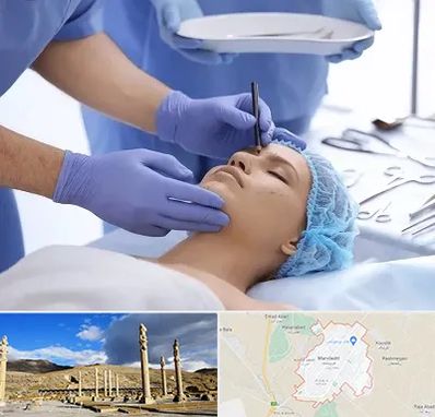 عمل بینی طبیعی در مرودشت