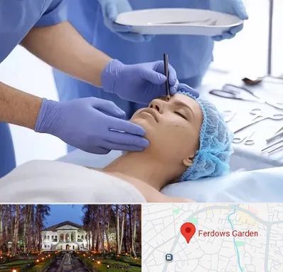 عمل بینی طبیعی در باغ فردوس