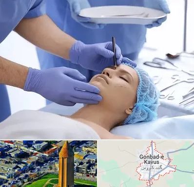 عمل بینی طبیعی در گنبد کاووس