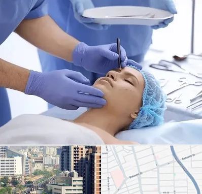 عمل بینی طبیعی در خیابان بهشتی
