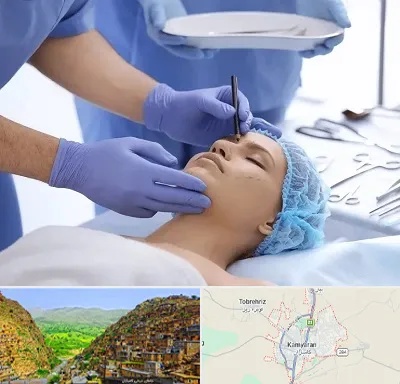 عمل بینی طبیعی در کامیاران
